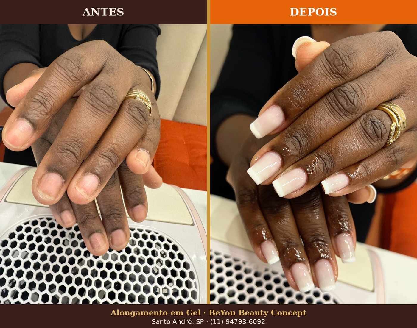 Antes e depois alongamento em gel – BeYou Beauty Concept Santo André