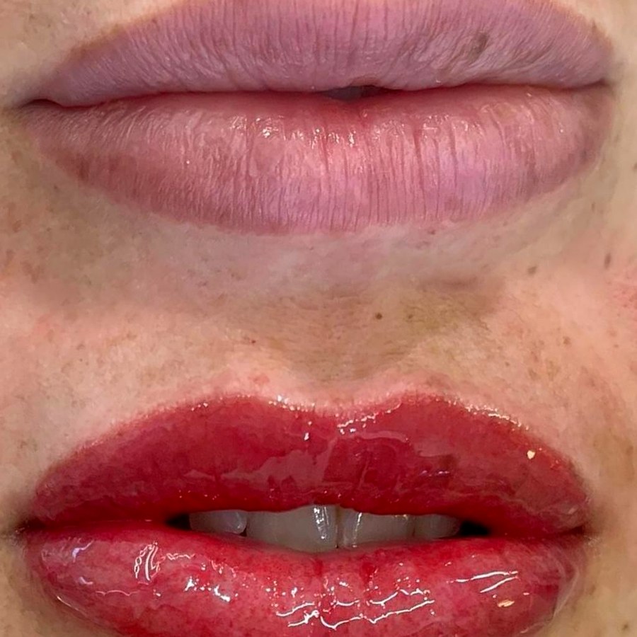 Lash lifting cílios – BeYou Santo André